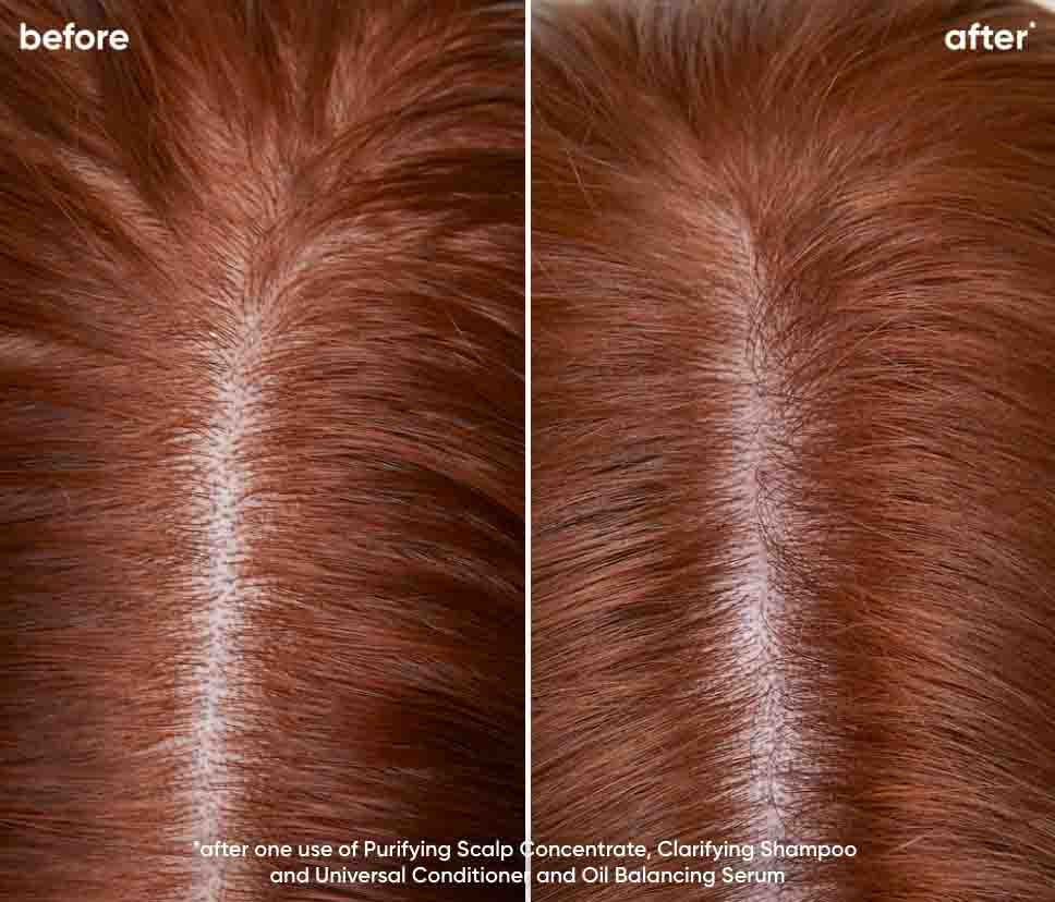 Biolage Scalp Sync Purifying Scalp Care Complete System result