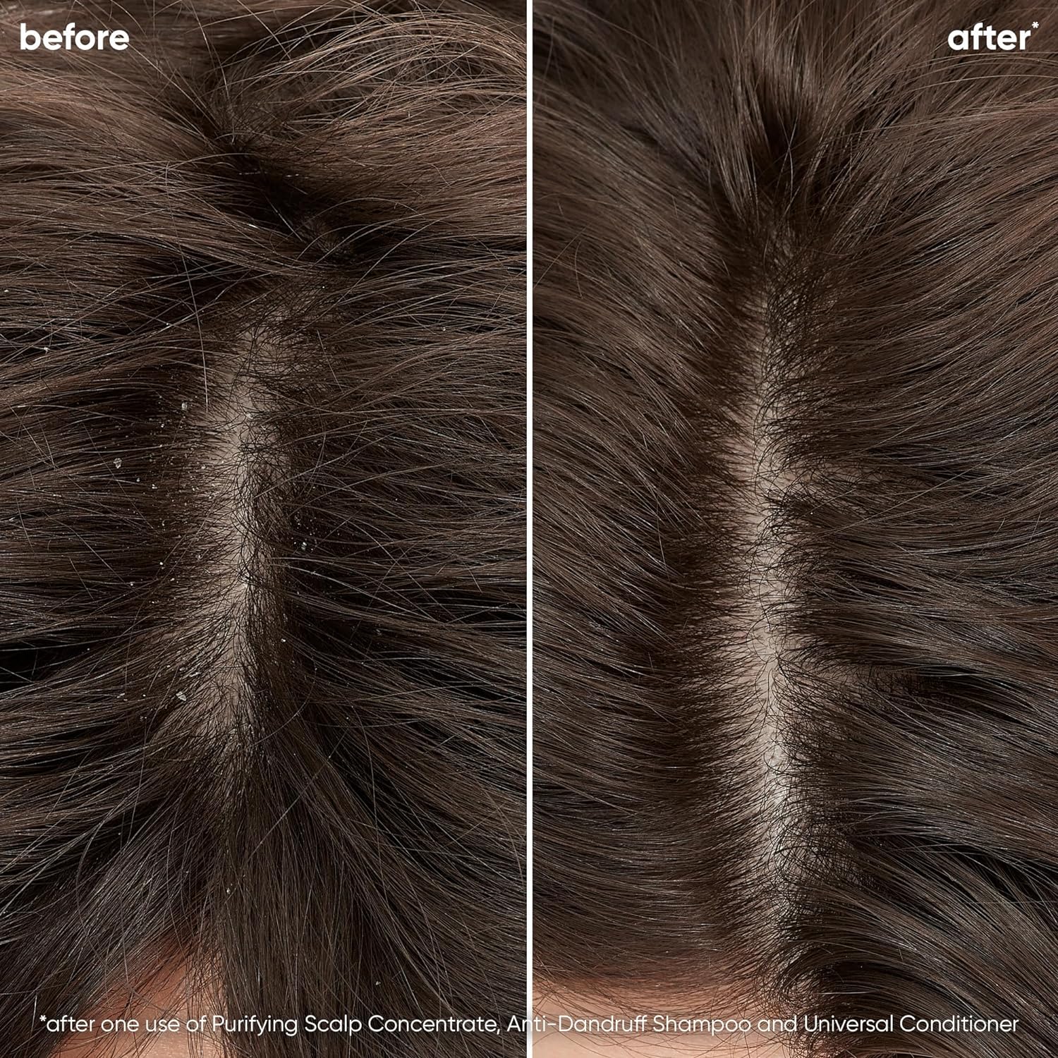 Biolage Scalp Sync Pyrithione Zinc Anti Danruff result