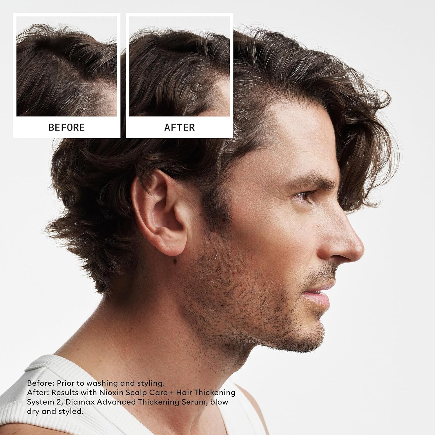 Nioxin Natural untreated hair thickening shampoo conditioner treatment for hair loss