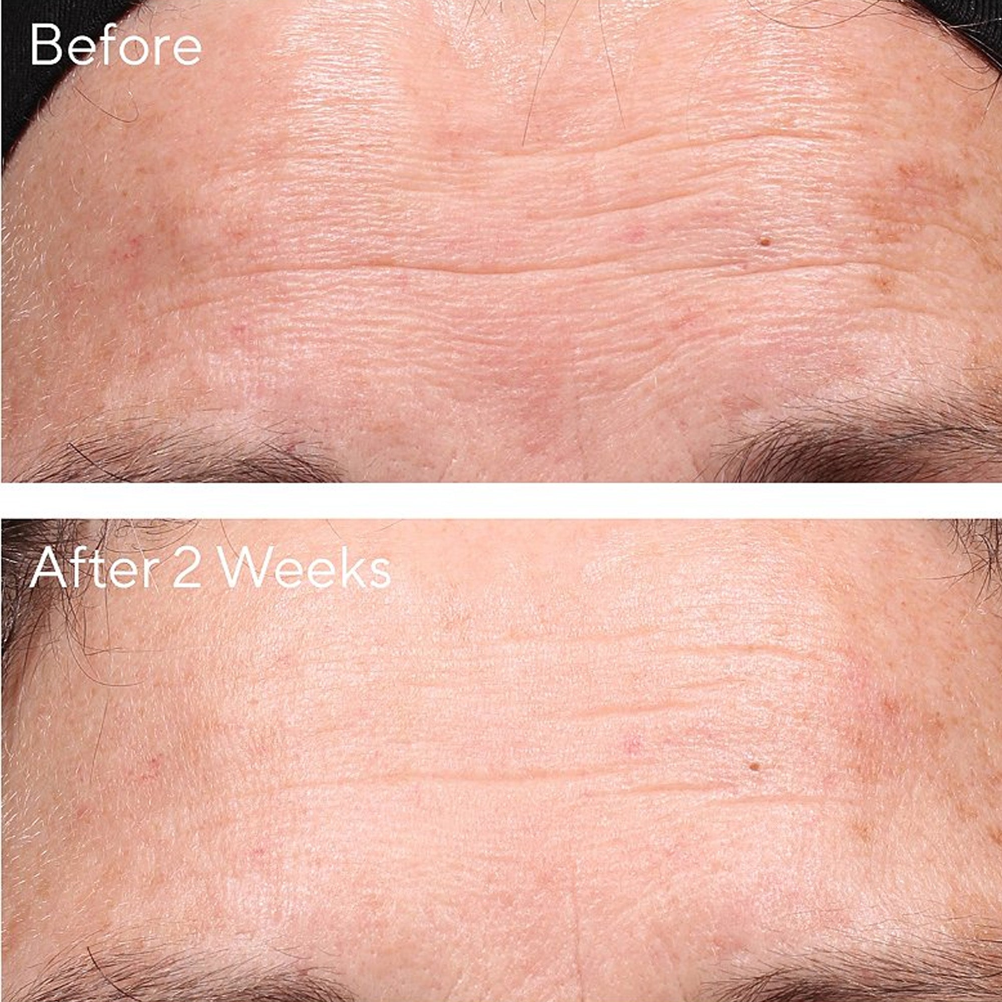 Murad Retinol Youth Renewal Night Cream