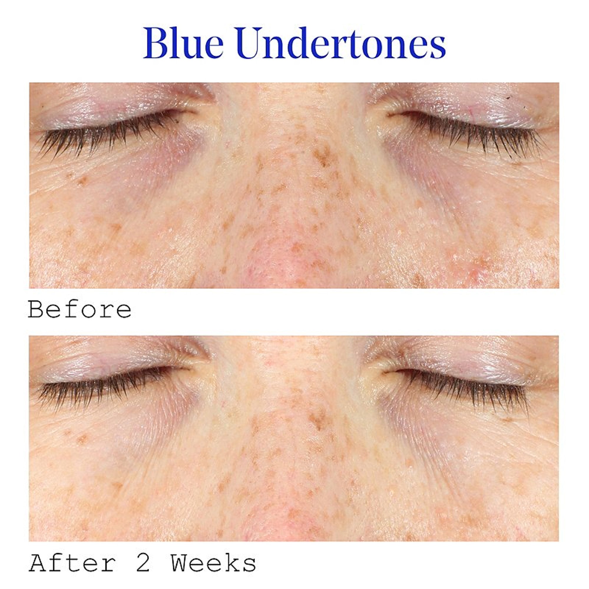 Murad Vita-C Eyes Dark Circle Corrector