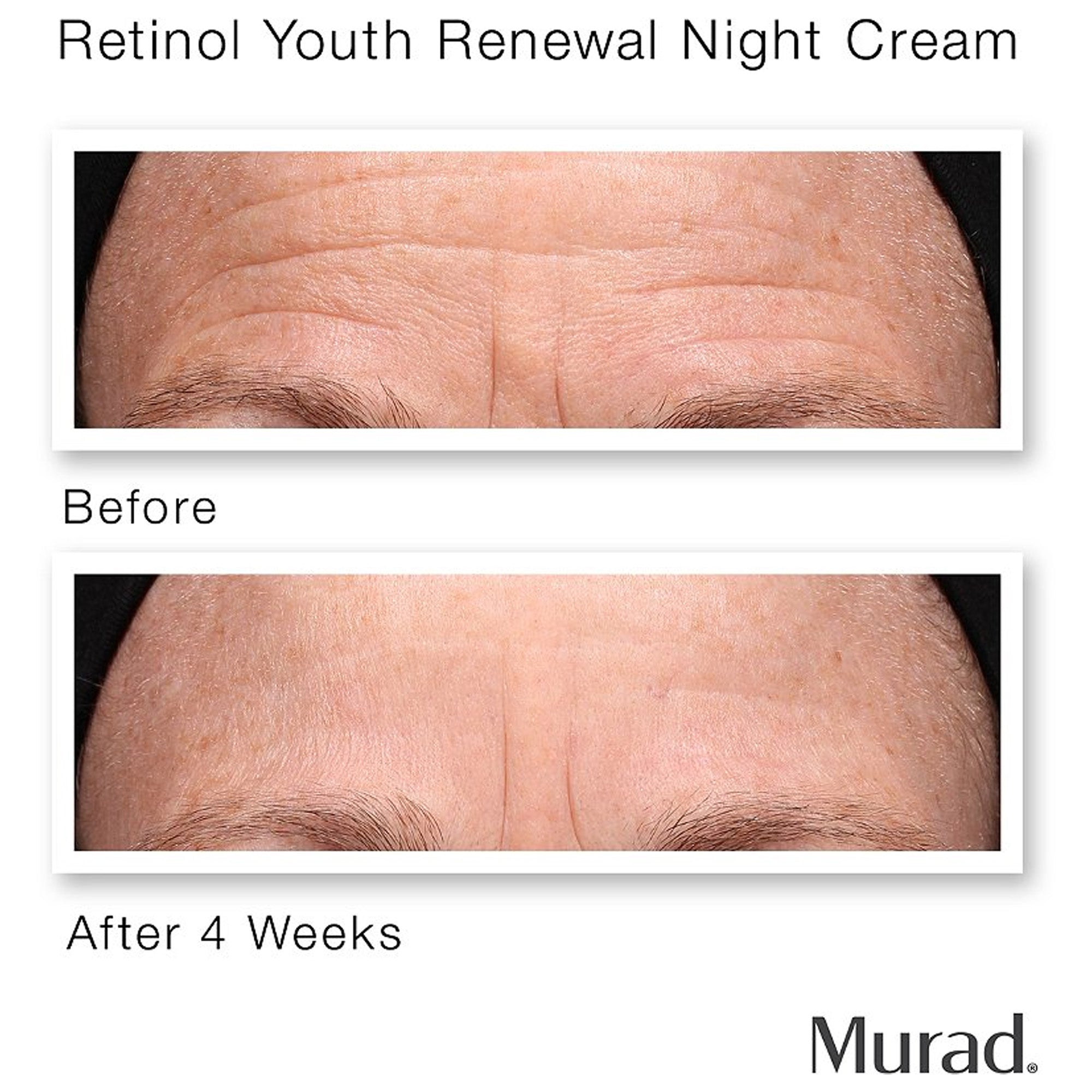 Murad Retinol Youth Renewal Serum
