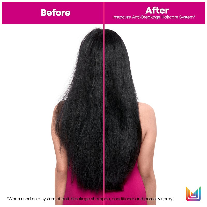 Matrix Total Results Insta Cure Set before and after