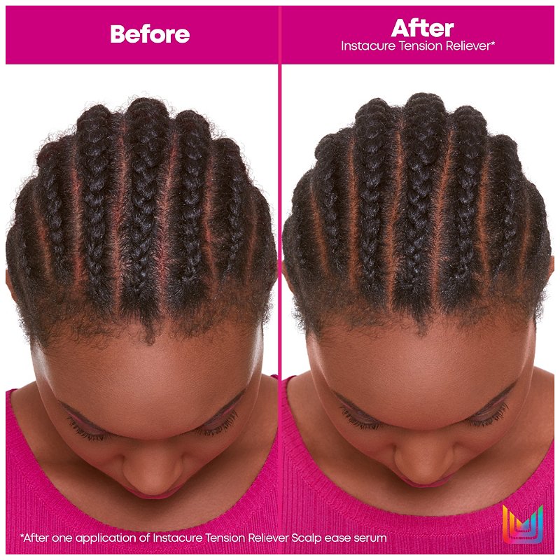 Matrix Total Results Insta Cure Set before and after