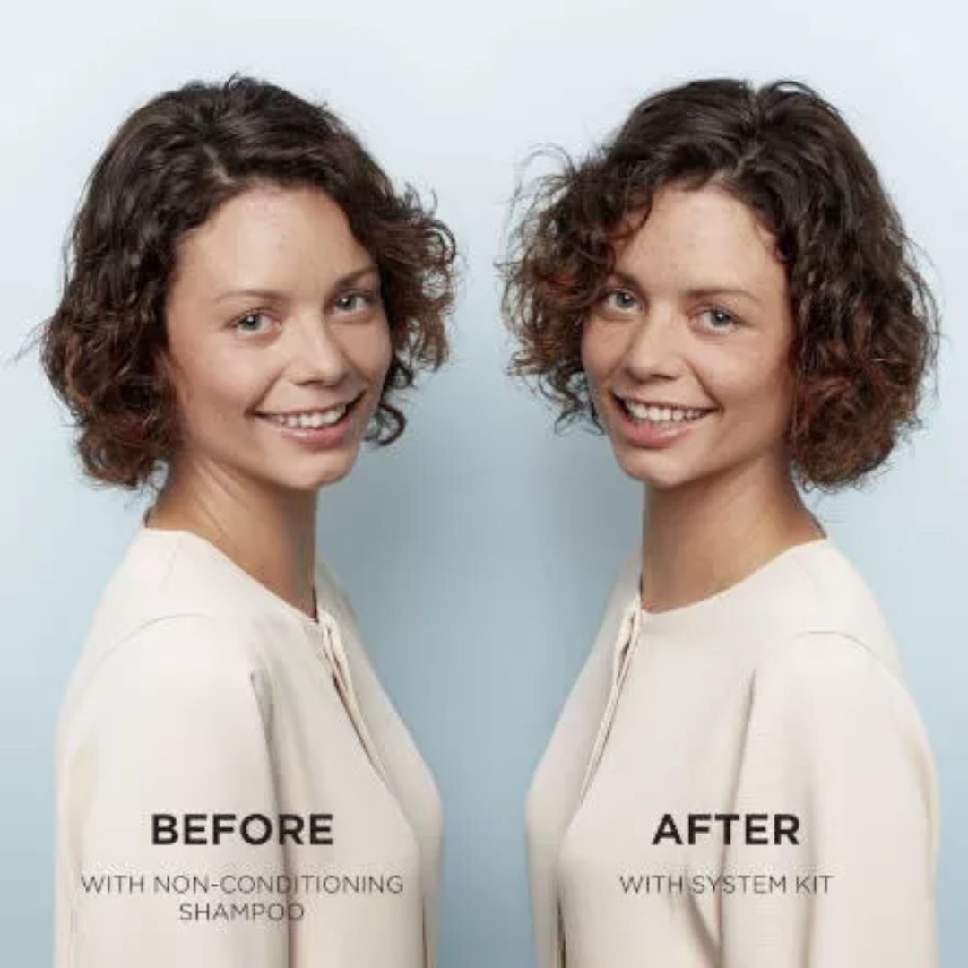 Nioxin Kit System 4 Before and After