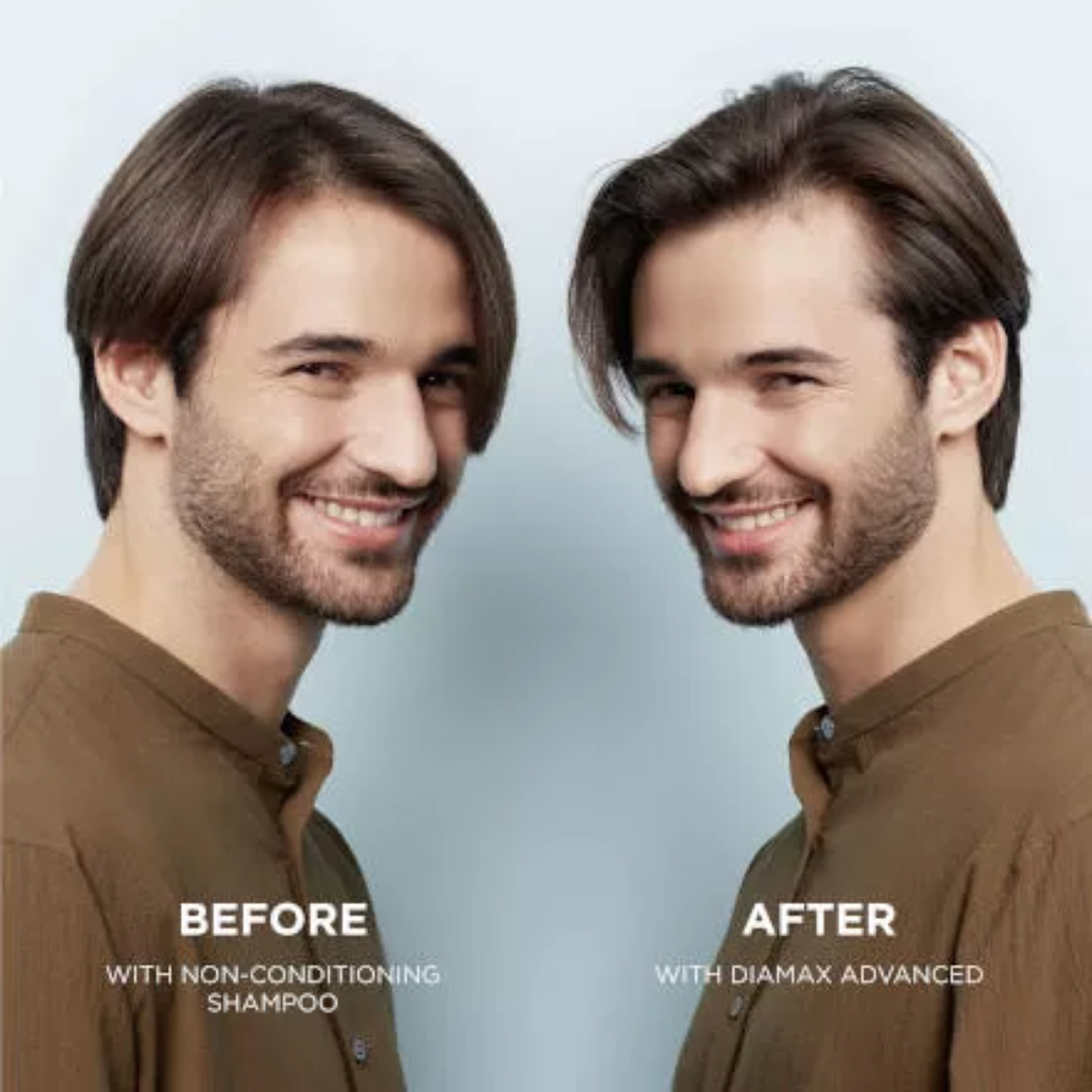 Nioxin Diamax Before and After