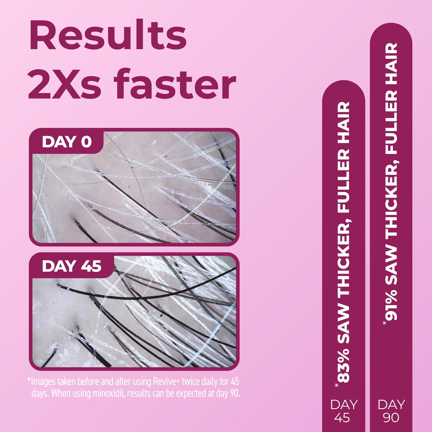 BosleyMD Women's Revive+ Densifying Foam result