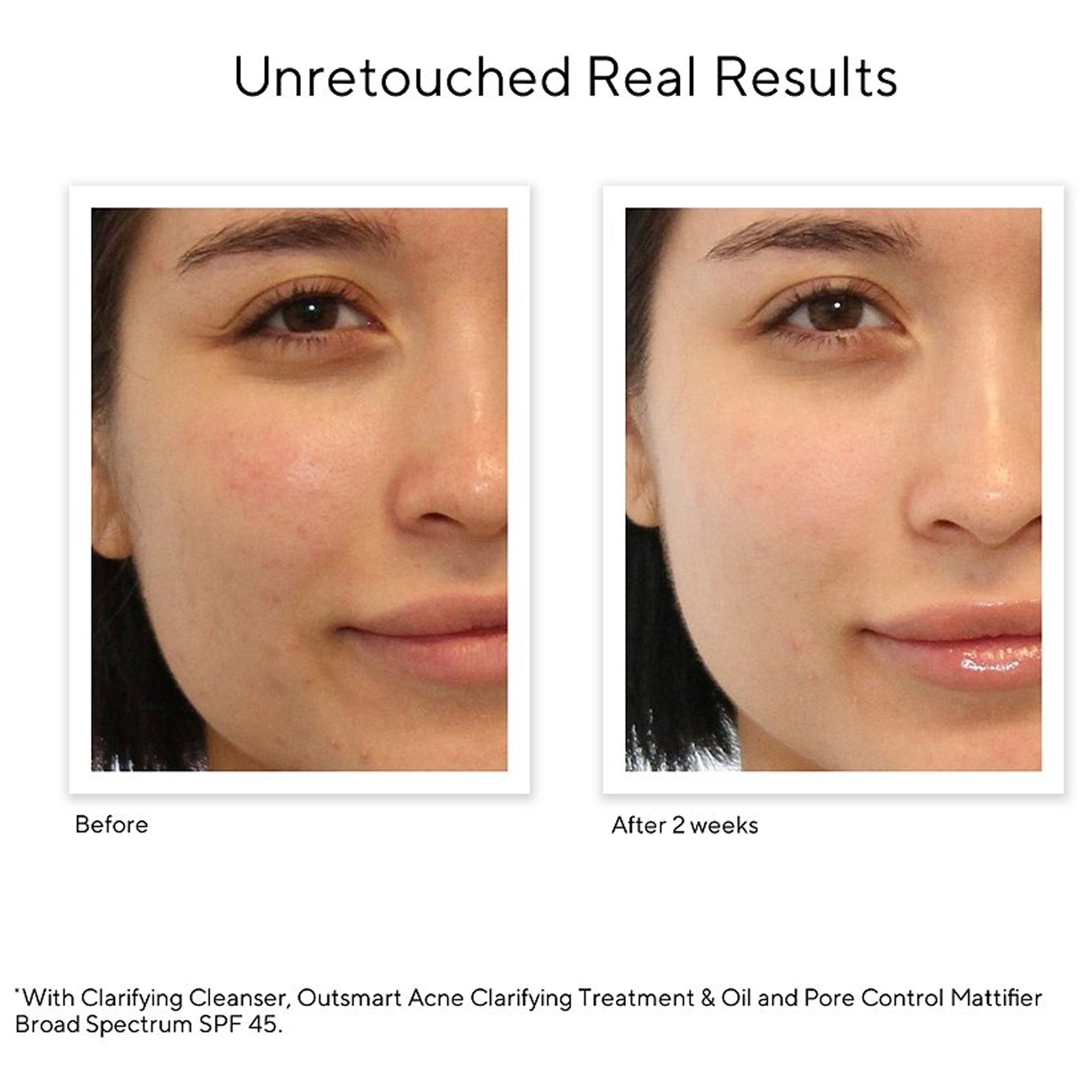 Murad  Acne Control Clarifying Cleanser Result