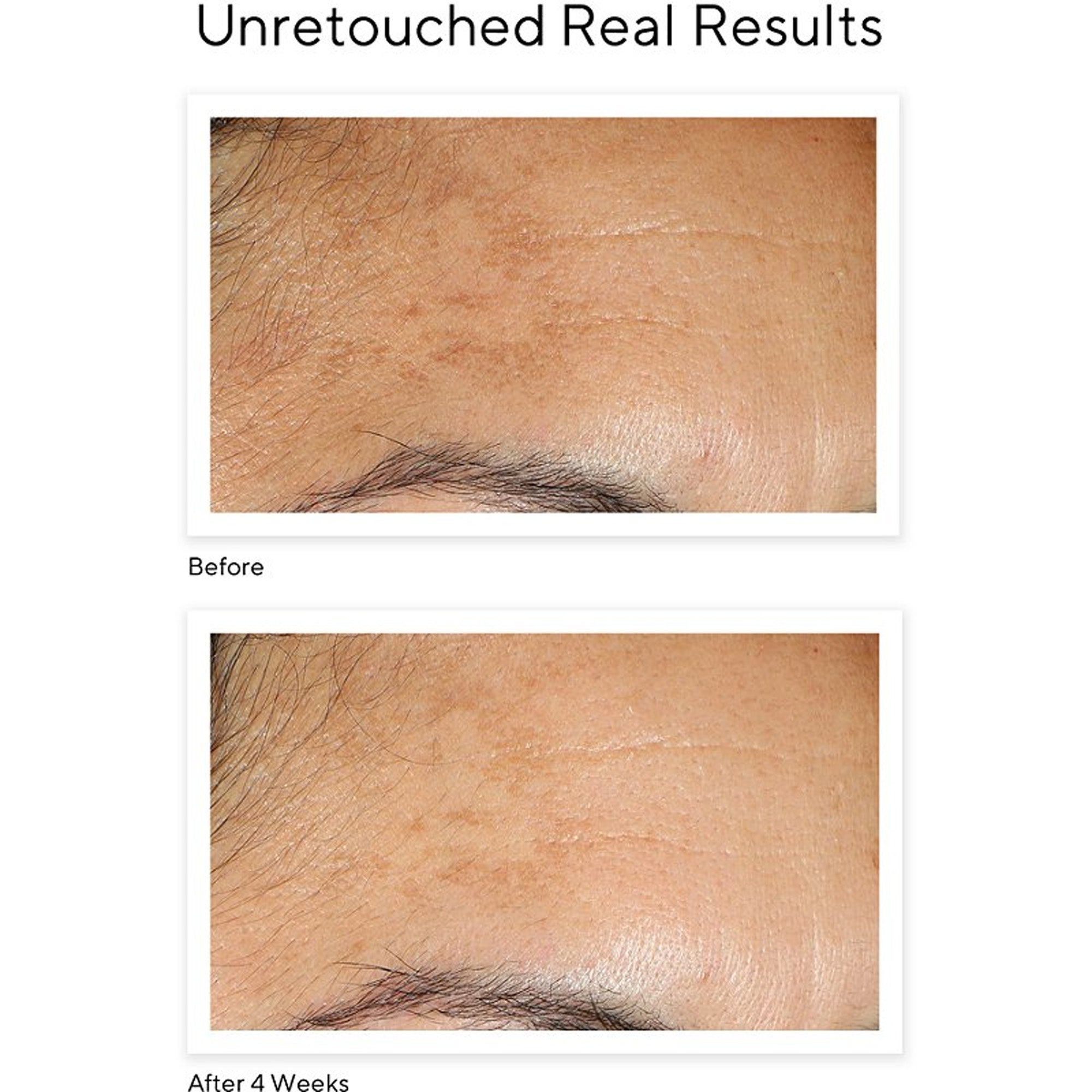 Murad Vita-C BEFORE AND AFTER