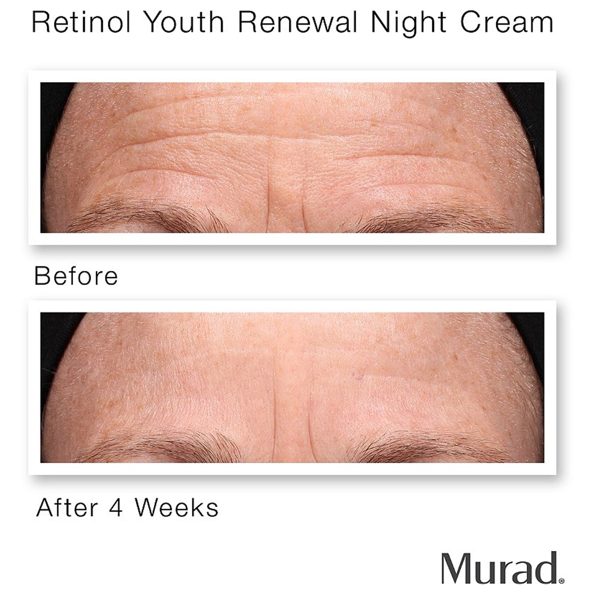 Murad Retinol Youth Renewal Serum 1oz / 30ml